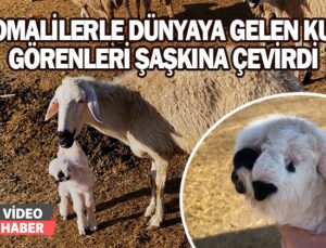 Çenesi Anormal Ve Sol Gözü Olmayan Kuzu, Görenleri Şaşkına Çevirdi